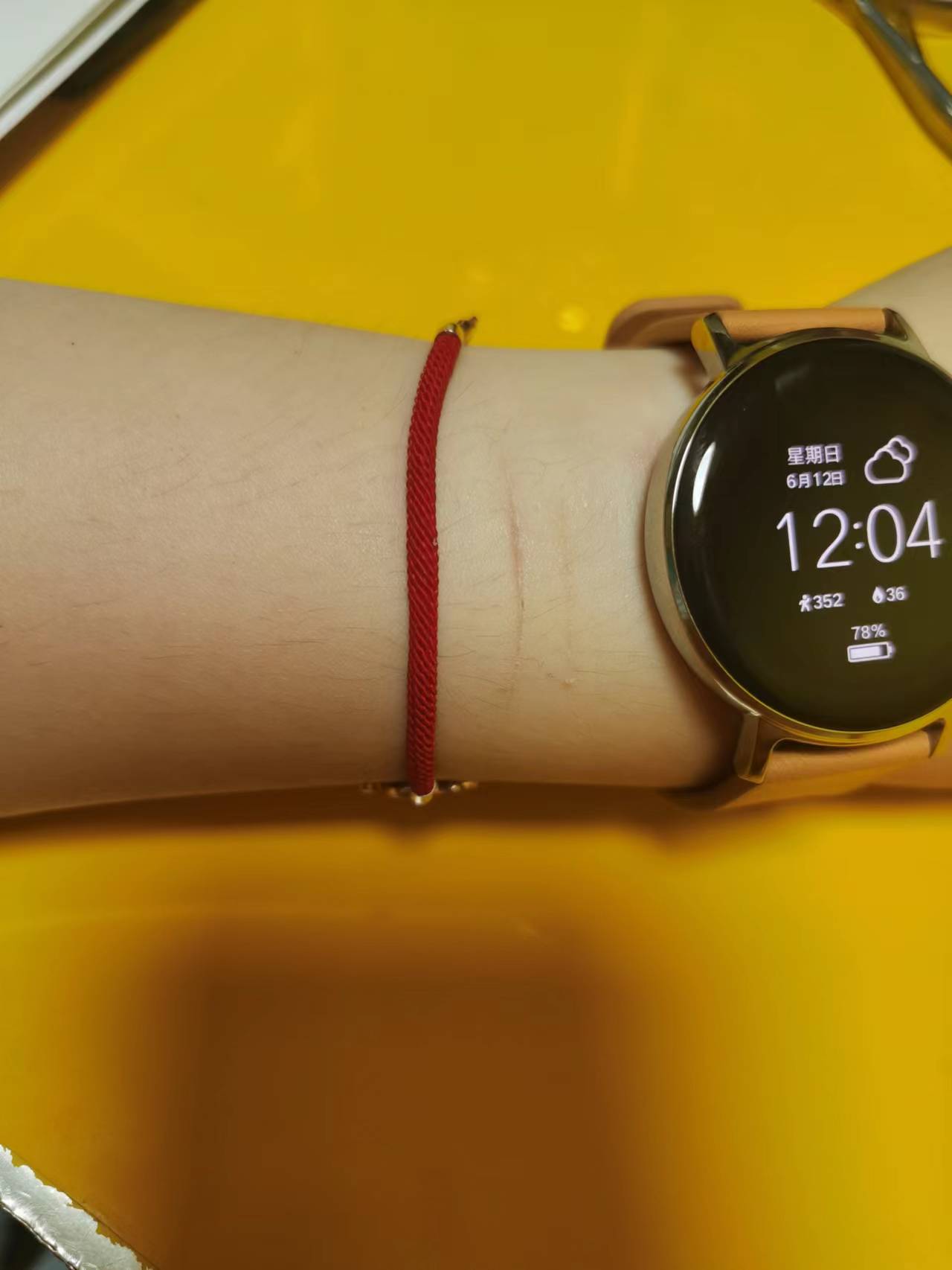 宝宝手腕上的伤（痛到我心里了）